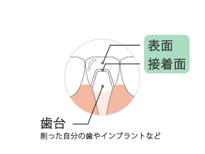 前歯の部位の説明図
