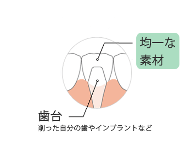 前歯の部位の説明図