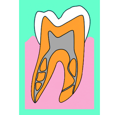 複雑な歯の根っこ